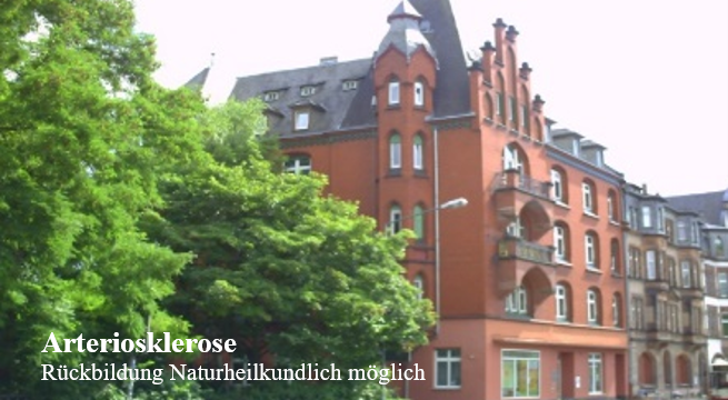 Arteriosklerose-Beratung